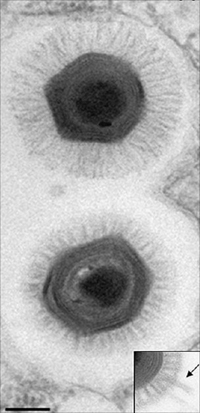 Cấu trúc của Megavirus chilensis giống như sợi tóc
